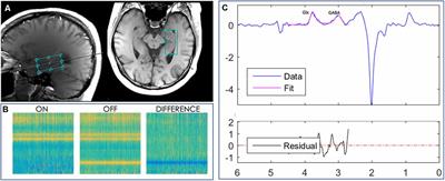 Reduced Hippocampal GABA+ Is Associated With Poorer Episodic Memory in Healthy Older Women: A Pilot Study